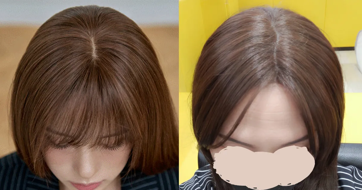 ピンクエイジのトップカバーはバレる？人工頭皮つき最新モデルを美容師