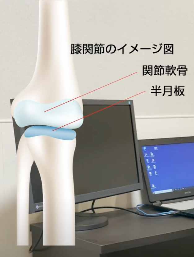半月板の再生医療について | お茶の水セルクリニック