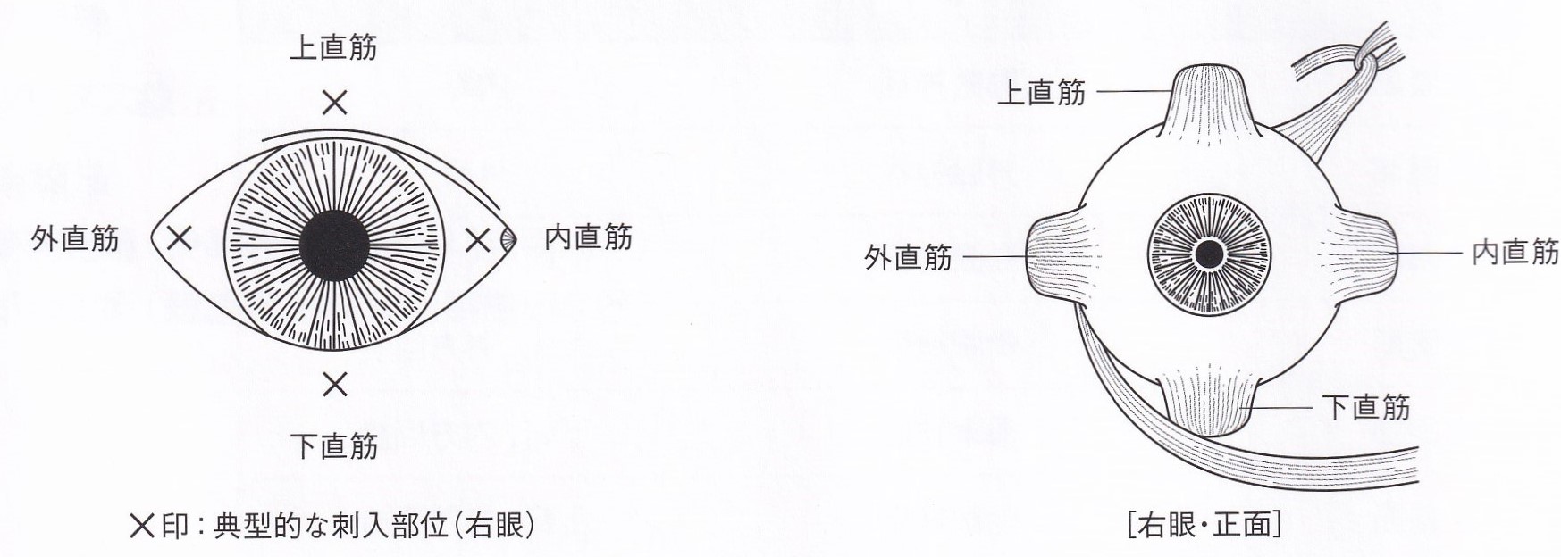 斜視に対するボツリヌス治療 - 医療法人 小笠原眼科クリニック
