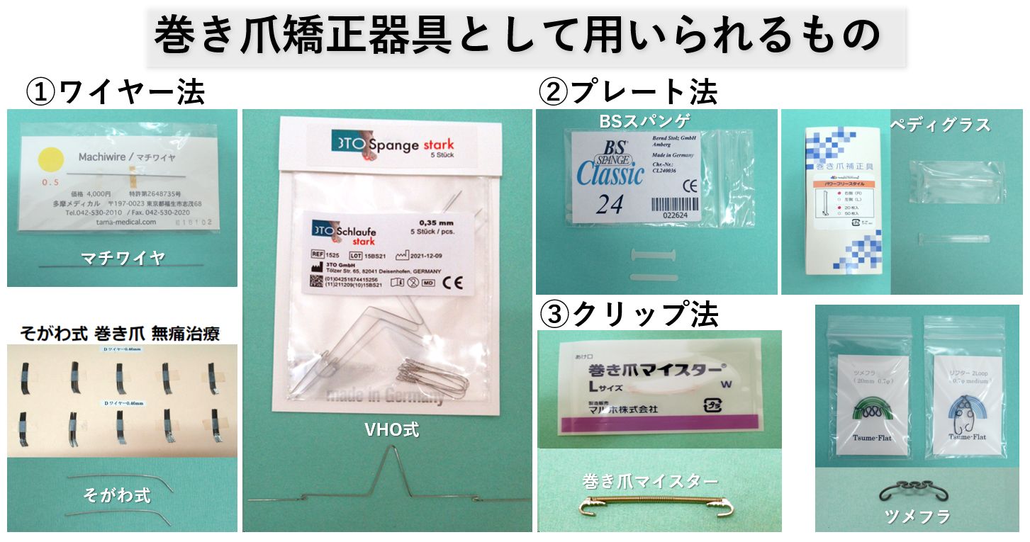 巻き爪矯正ワイヤー治療/病院おすすめ矯正器具の効果｜大田区大森