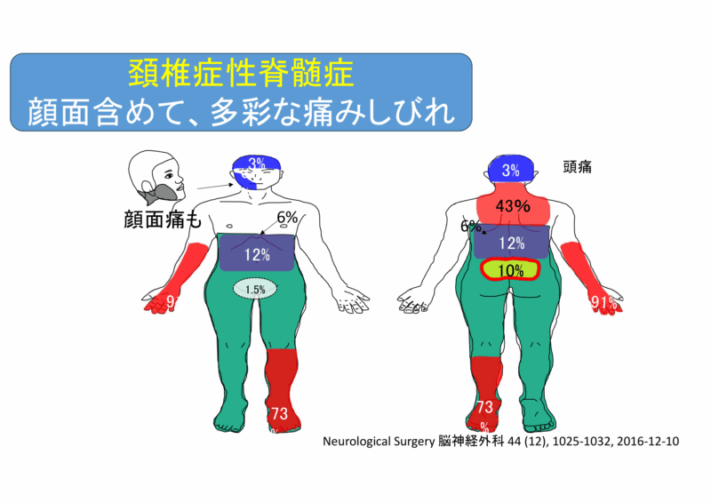 胸痛で発症した頚椎椎間板ヘルニア | 淡海せぼねクリニックブログ