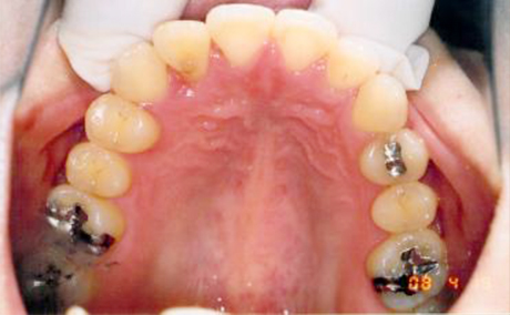 スリーピング矯正の「大塚駅前歯科」