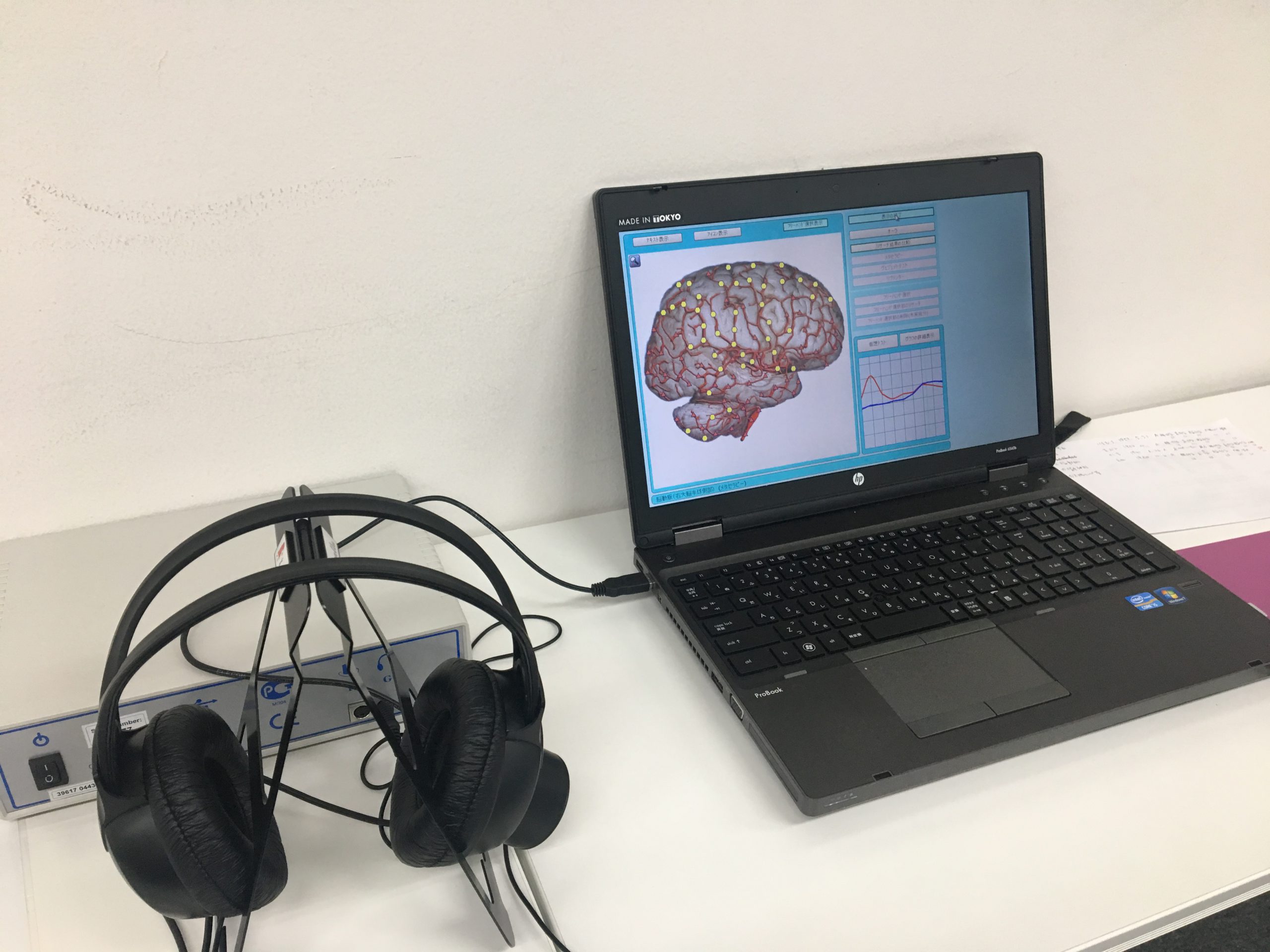 ニュースキャン 健康測定 - 大きなきりかぶ