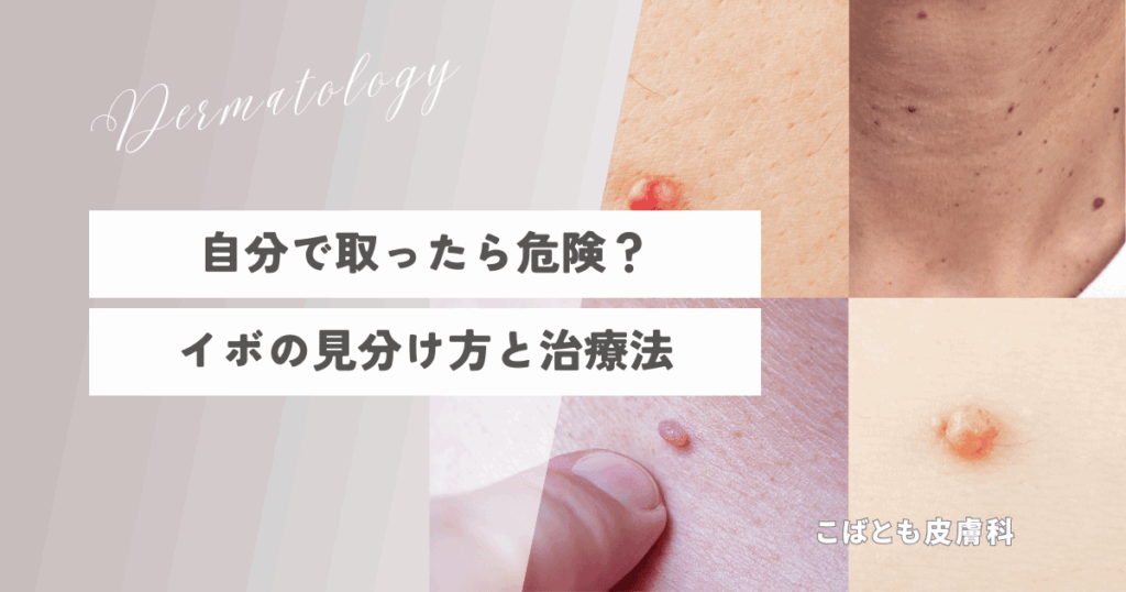 wart-self-removal-risk-