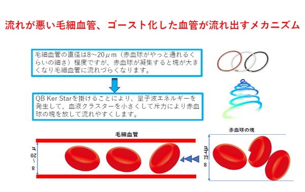KEPAMOI（ケパモイ）「 QBボール内臓サポーター」 | すべての商品