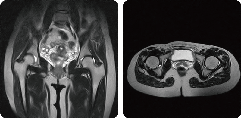 MRI検査 | 医療法人社団月山会 おやま整形外科クリニック