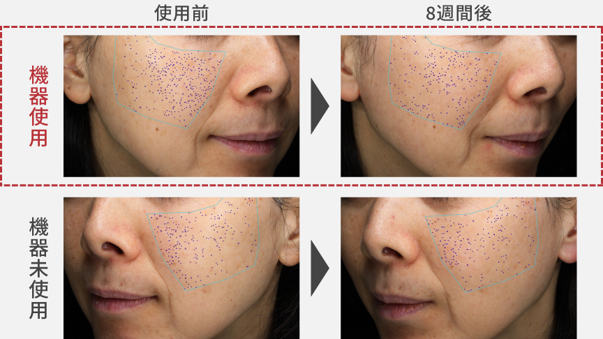 商品特長・効果 | 特長 光美顔器 フォト ブライトショット EH-SL85