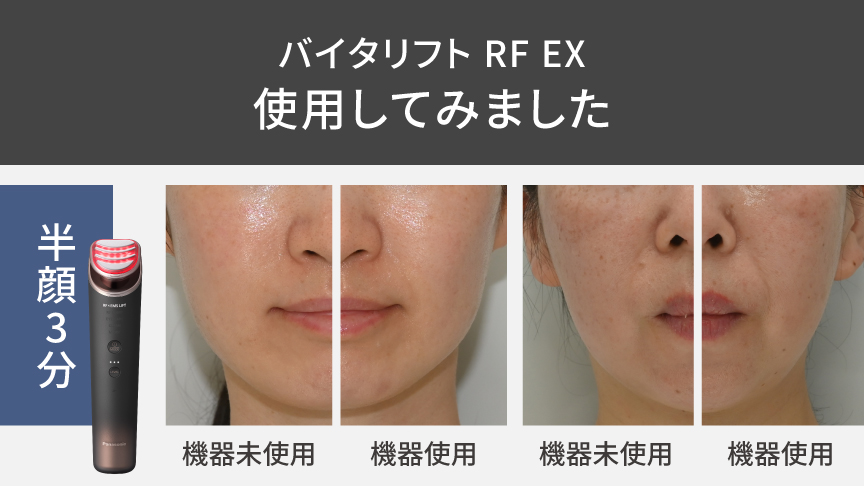 商品特長・効果 | 特長 リフトケア美顔器 バイタリフト RF EX EH-SR86