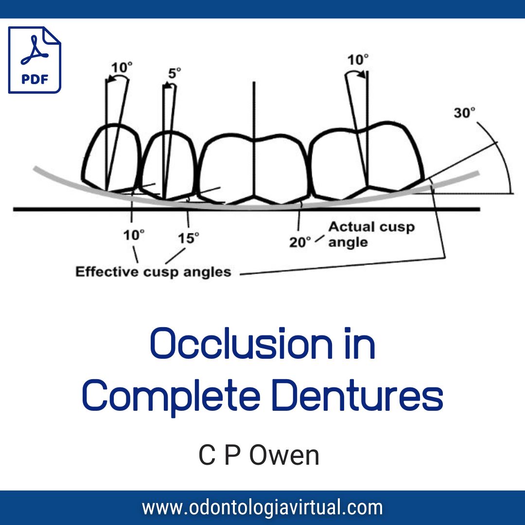 OCCLUSION【裁断済】 ENCYCLOPAEDIA of
