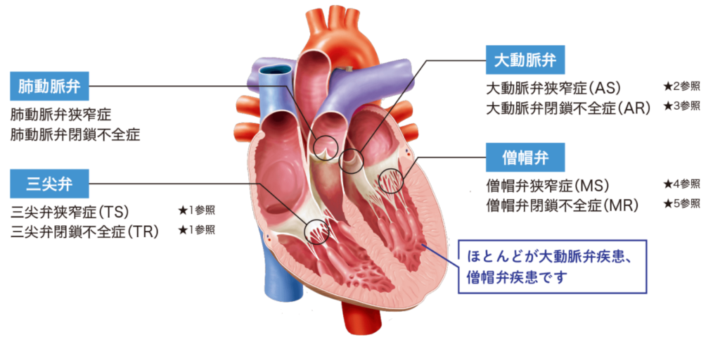 心エコーに関する基礎から要点だけをわかりやすく説明します