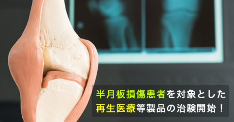 国内初】半月板損傷患者を対象とした再生医療等製品の治験開始