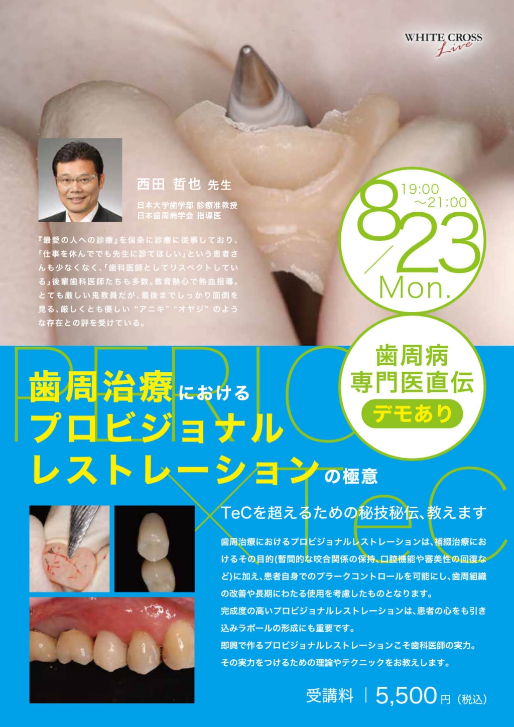 録画配信］歯周治療におけるプロビジョナルレストレーションの極意