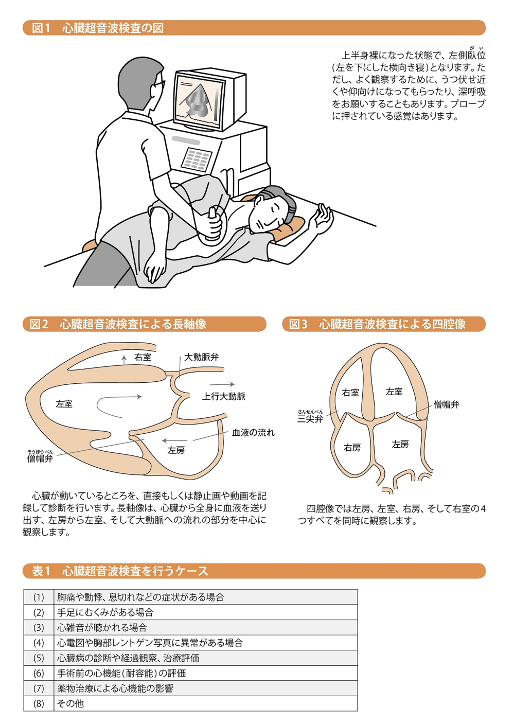 心臓の形や動きのチェックはからだへの負担が少ない超音波で