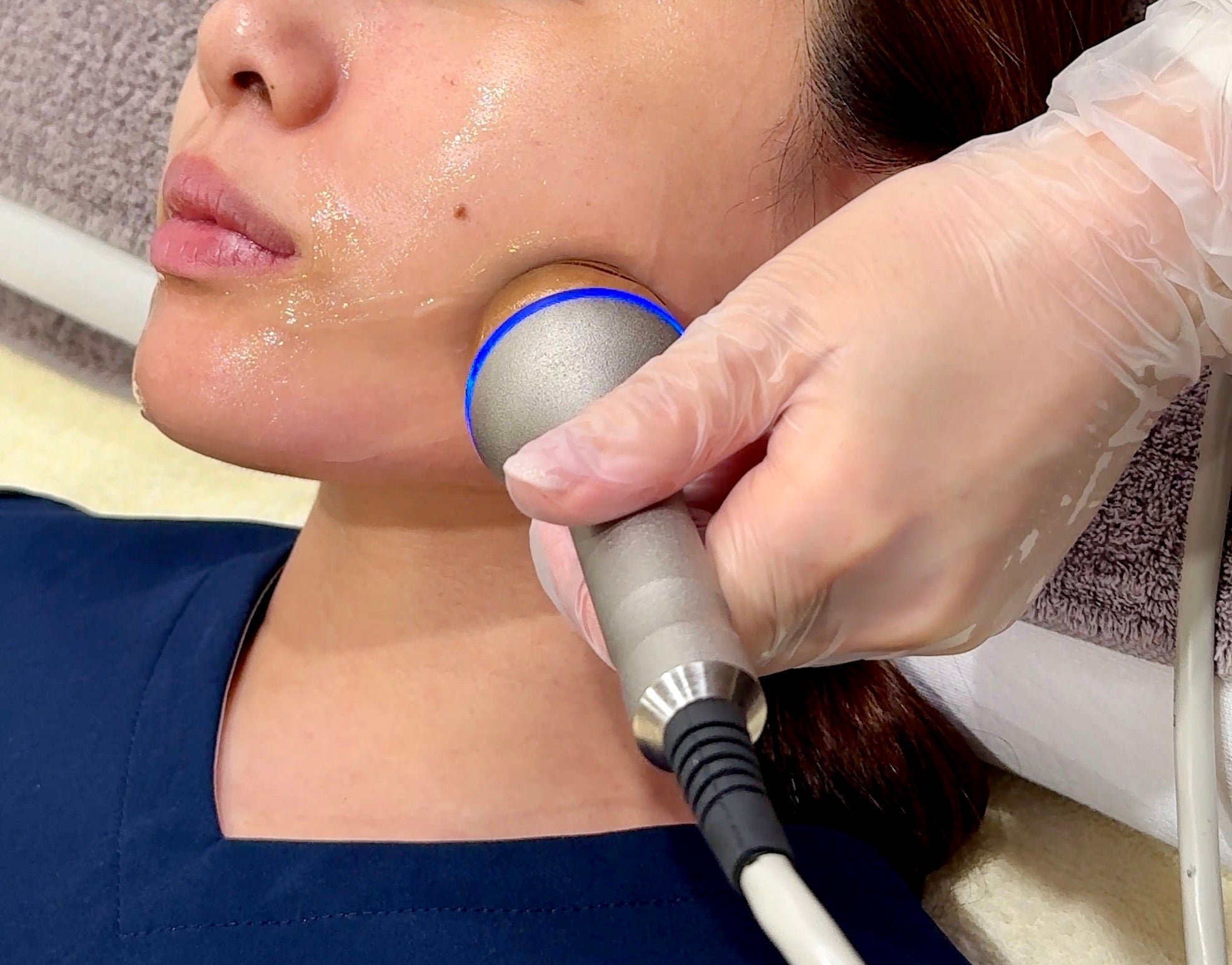 東北・仙台で初導入】細胞レベルで肌を覚醒させる次世代スキンリフト