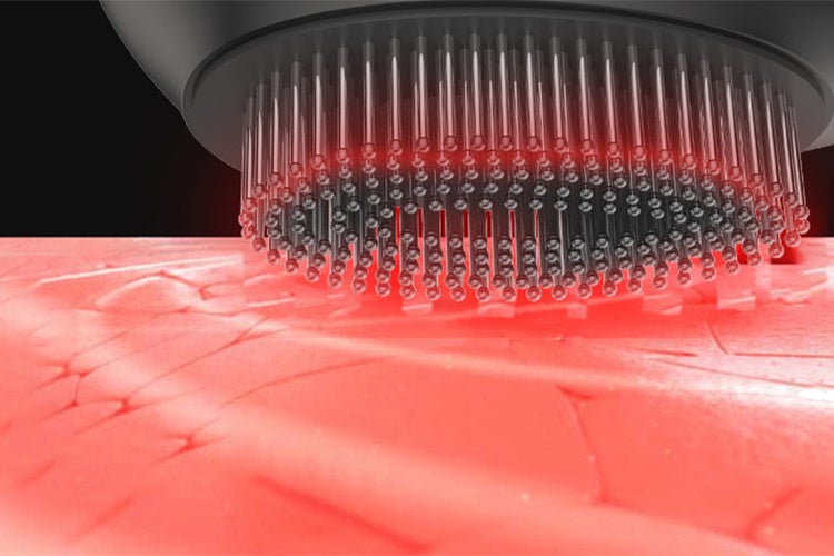 低出力レーザーLLLT搭載プラズマイオン電気ブラシ「DERMALUMINA