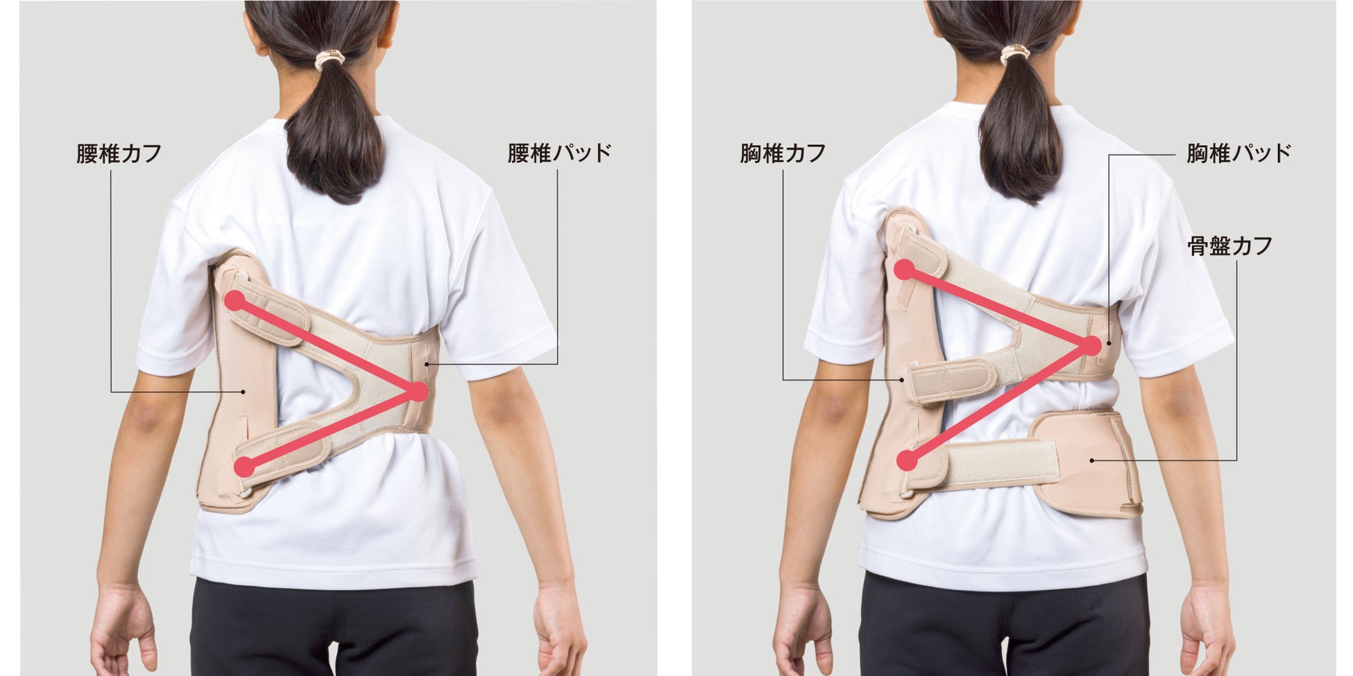 大塚整体治療院 側弯症矯正道具