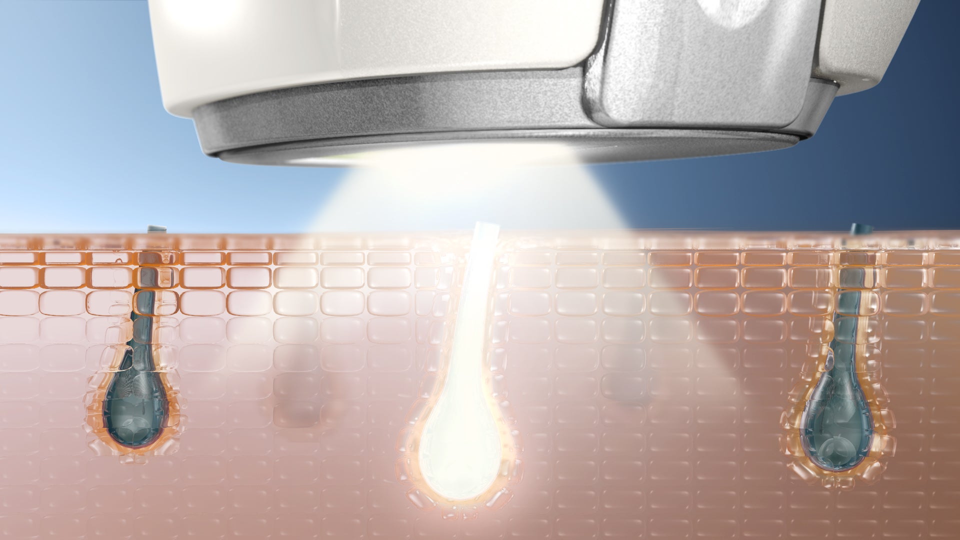 TVCMも放映スタート】簡単操作で本格的なムダ毛ケアを叶えるIPL光美容