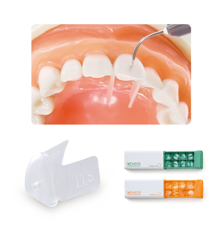 プレミアムプラスジャパン｜Premium Plus Japan｜歯冠修復