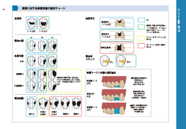 オーバーレイ修復”のステップや 勘所をビジュアルに解説した1冊