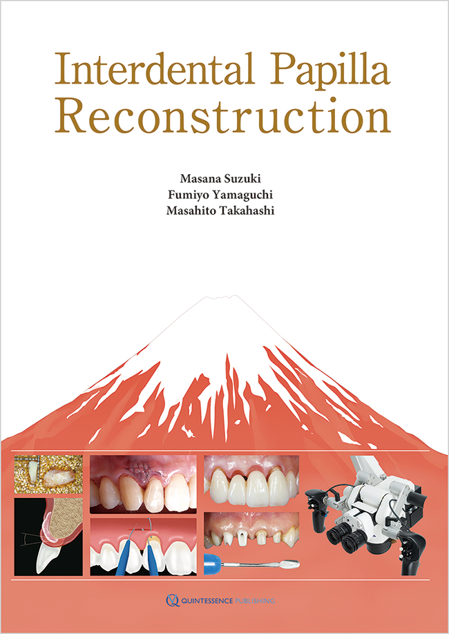 Interdental Papilla Reconstruction | Masana Suzuki / Fumiyo