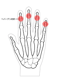 関節の痛み | さとう埼玉リウマチクリニック《大宮院》｜さいたま市の