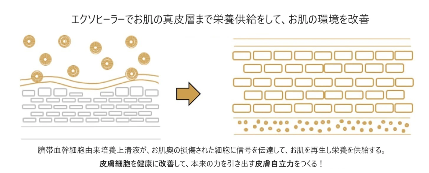 エクソヒーラー（臍帯血幹細胞由来培養上清液） | リアルクリニック