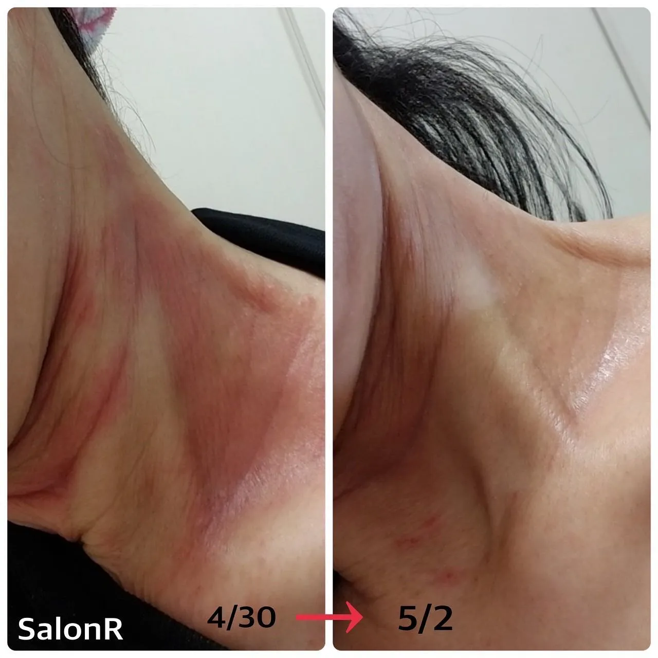 REVIのNMNナノフェザーパウダーが凄すぎる、、（サロン商 | ブログ