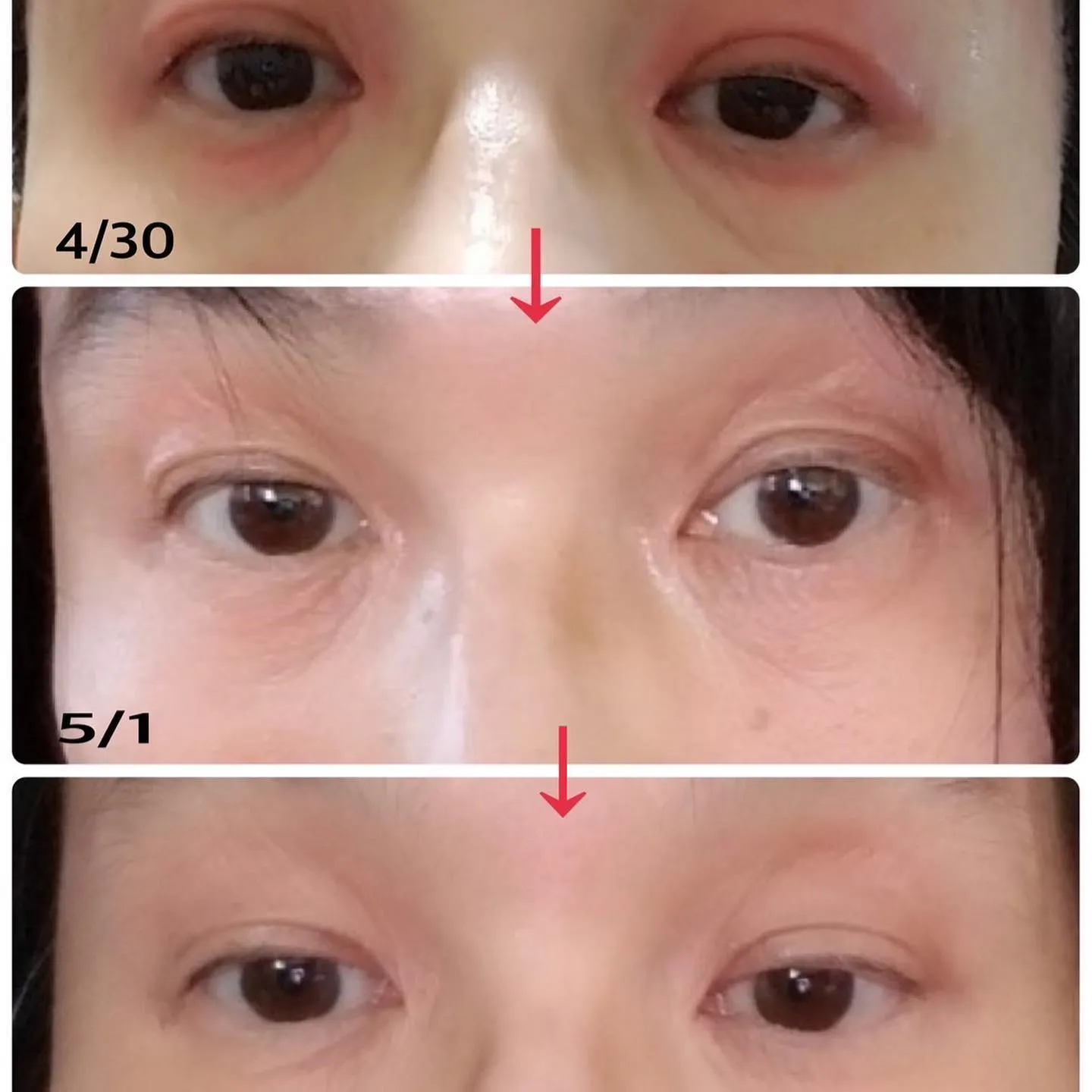 REVIのNMNナノフェザーパウダーが凄すぎる、、（サロン商 | ブログ