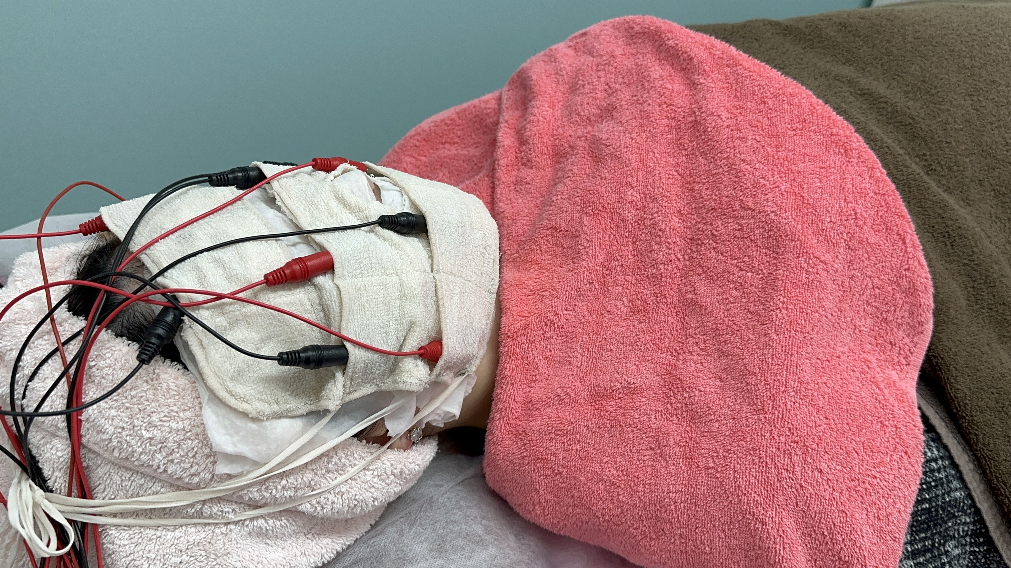 イオン導入・バイオニックセルサー ｜美容皮膚科 岡山マリアクリニック