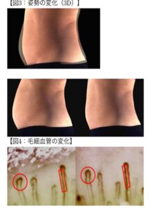 RE:SET とは – 長岡市の美容整体 ロウズィエト