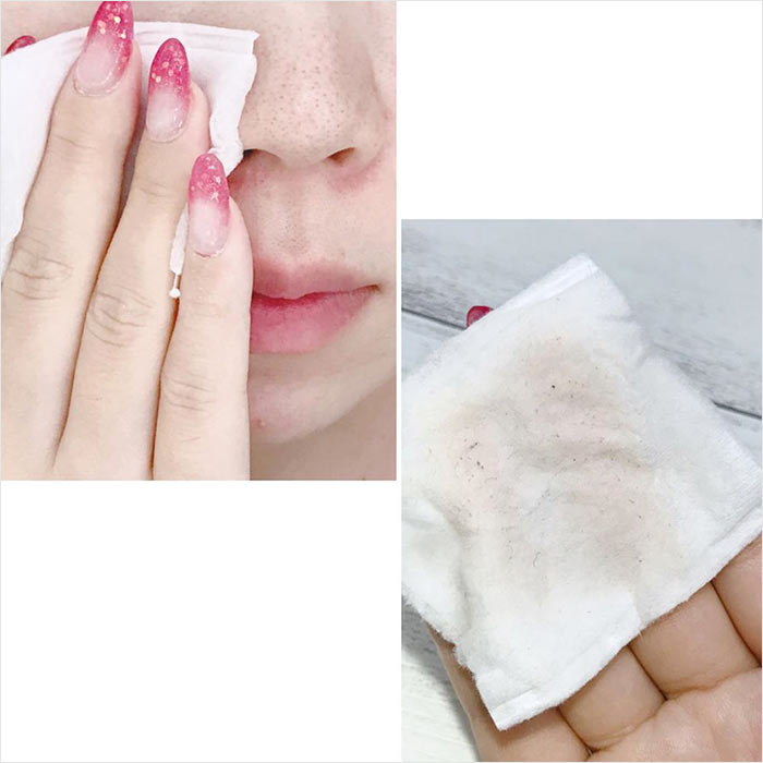 拭き取り化粧水 シカケア バランシングトナー｜ロベクチン日本公式サイト