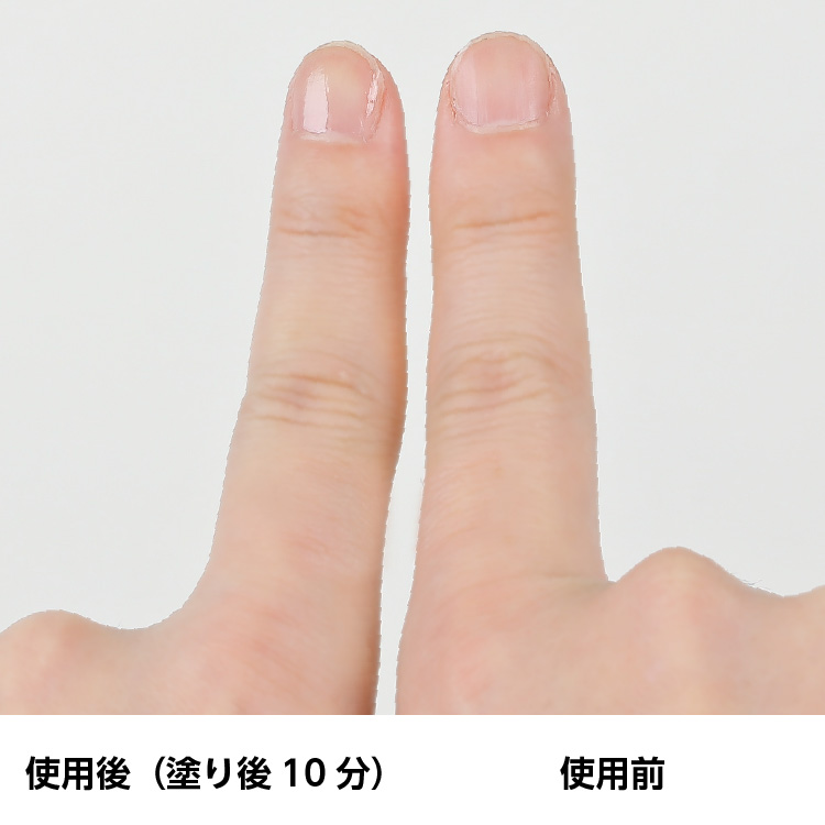 抗がん剤治療 爪 トップコート ZOYAアーマートップコート | 爪補強