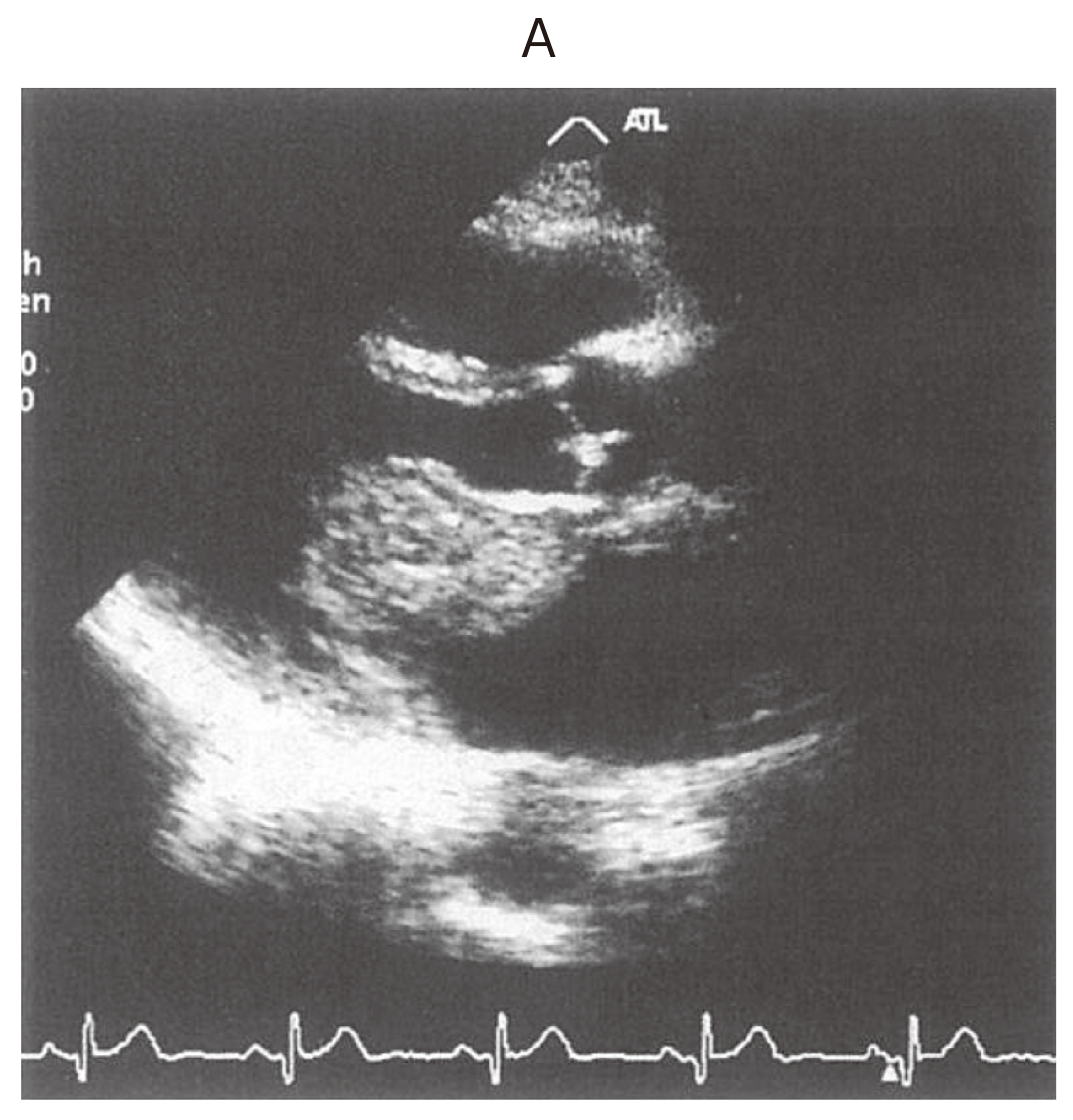 98B13 | 心臓腫瘍 国試 | テコプラ