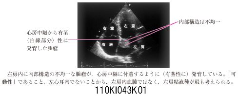 110I43 | 心臓腫瘍 国試 | テコプラ