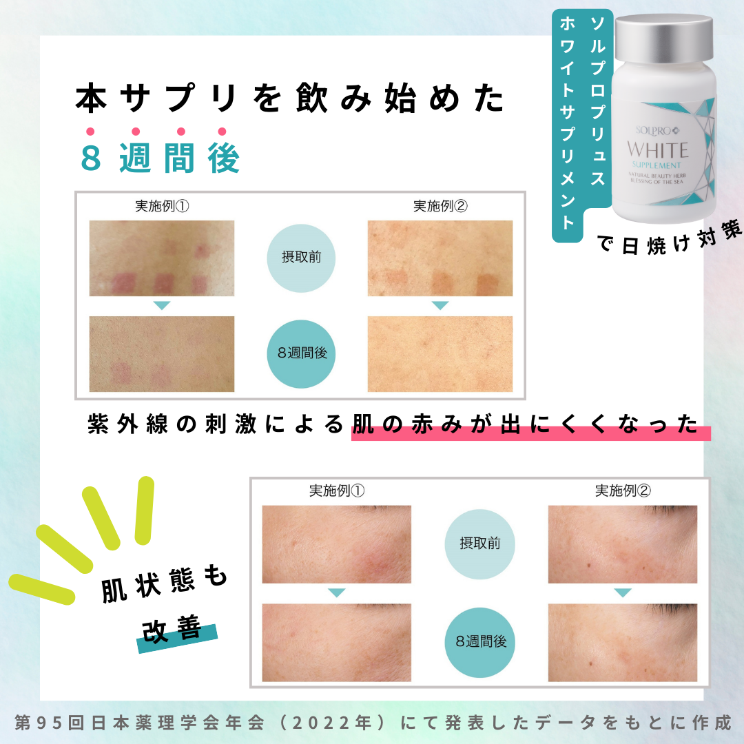 ソルプロプリュスホワイトサプリメント（飲む日焼け止め