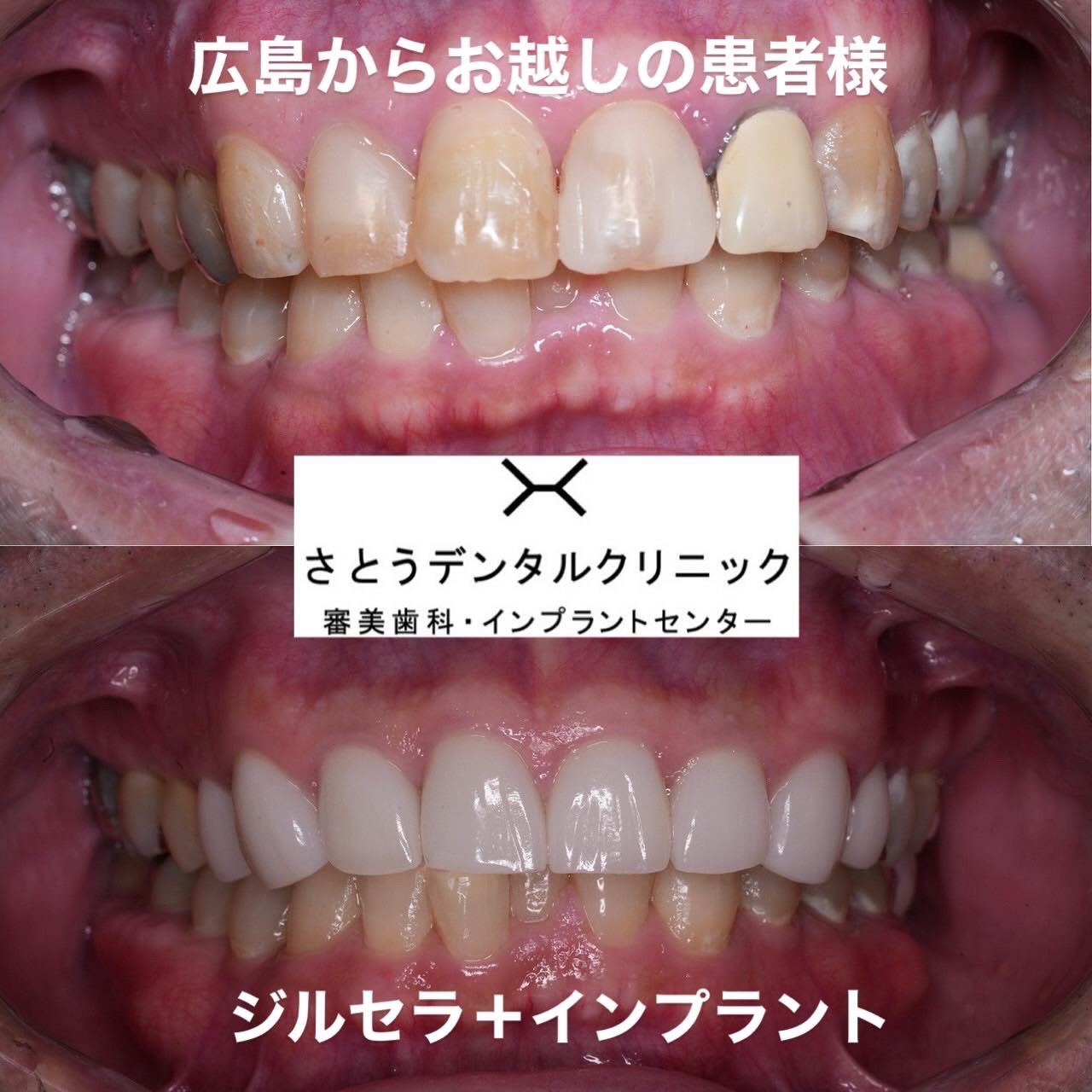 症例集 | 横浜駅徒歩3分の歯医者 さとうデンタルクリニック