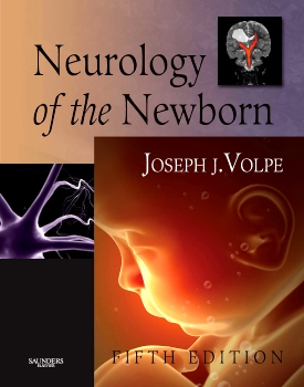 Neurology of the Newborn - 5th Edition | Elsevier Shop