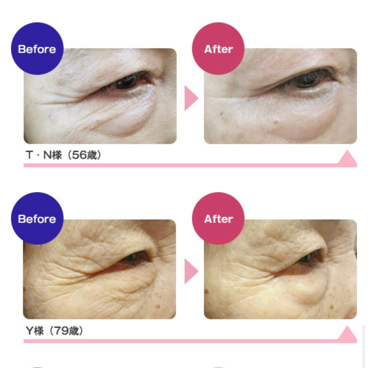 要問合せ】ロージードロップ パーフェクト ストレッチ シート – KOH