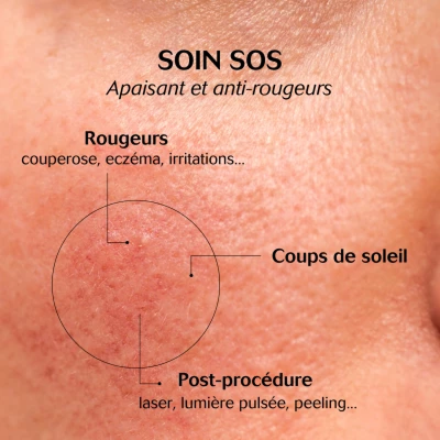 CEBELIA 保湿ケアクリーム（セベリア） – elife公式ショップ