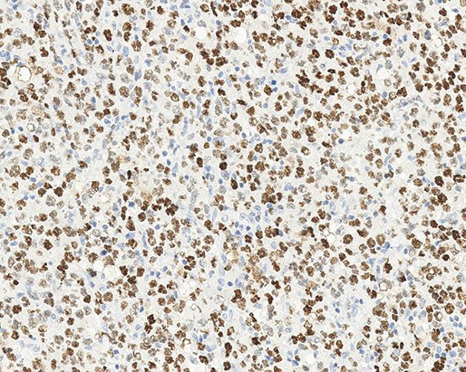 Bcl-6 Oncoprotein - IHC Primary Antibodies
