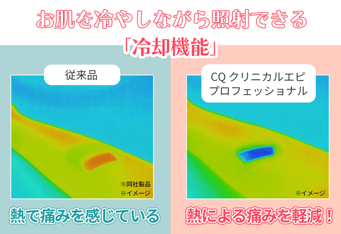 CQ クリニカルエピプロフェッショナル／ムダ毛ケアアイテム | TBS