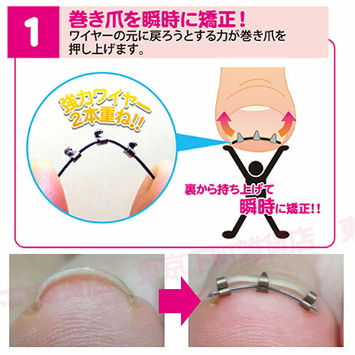 正規品 1個単品 まきづめリフト 4個クリップ 巻き爪 巻きづめ 矯正