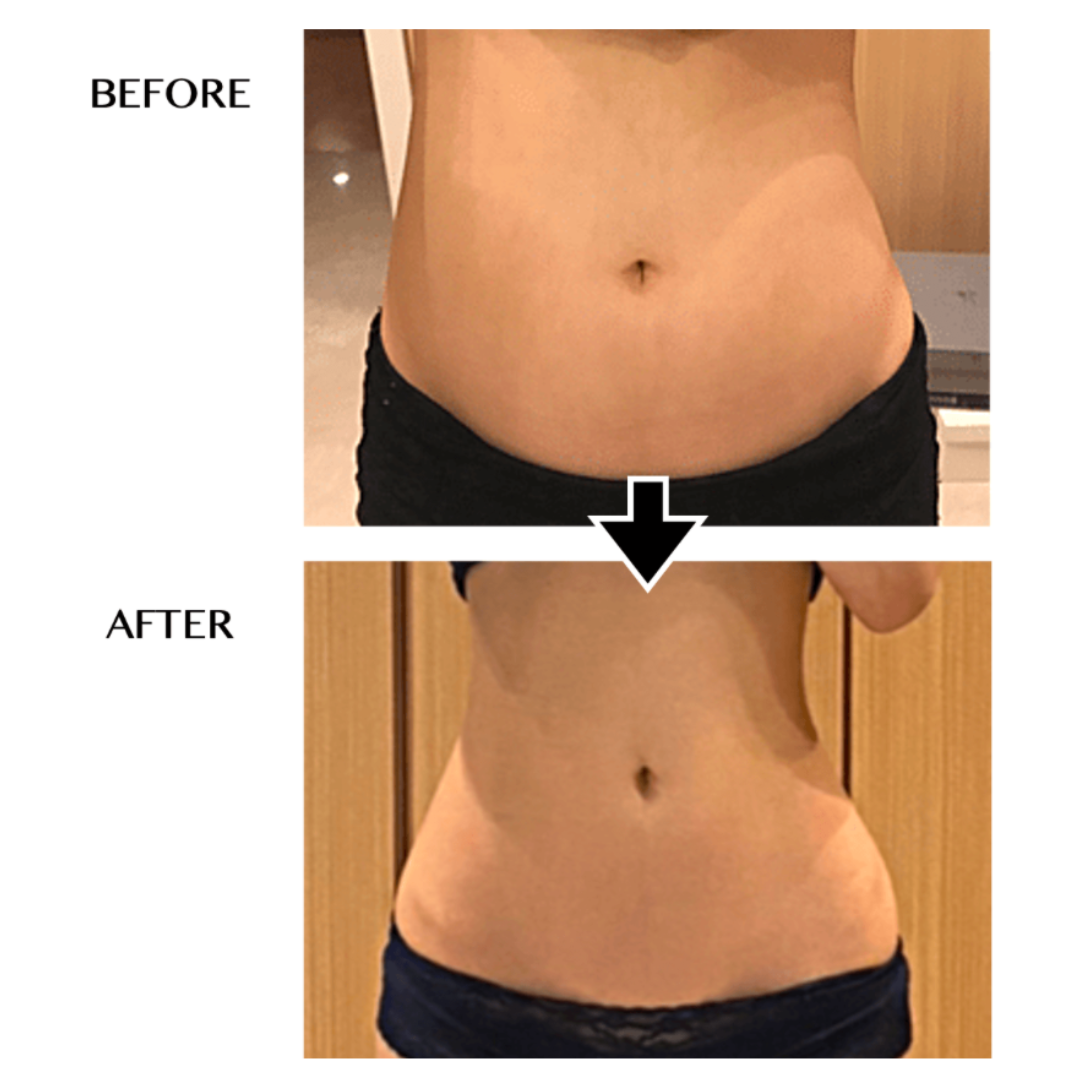 セルゼロ CELLZERO セルゼロバック BAG 美顔器・スチーマー 【メーカー