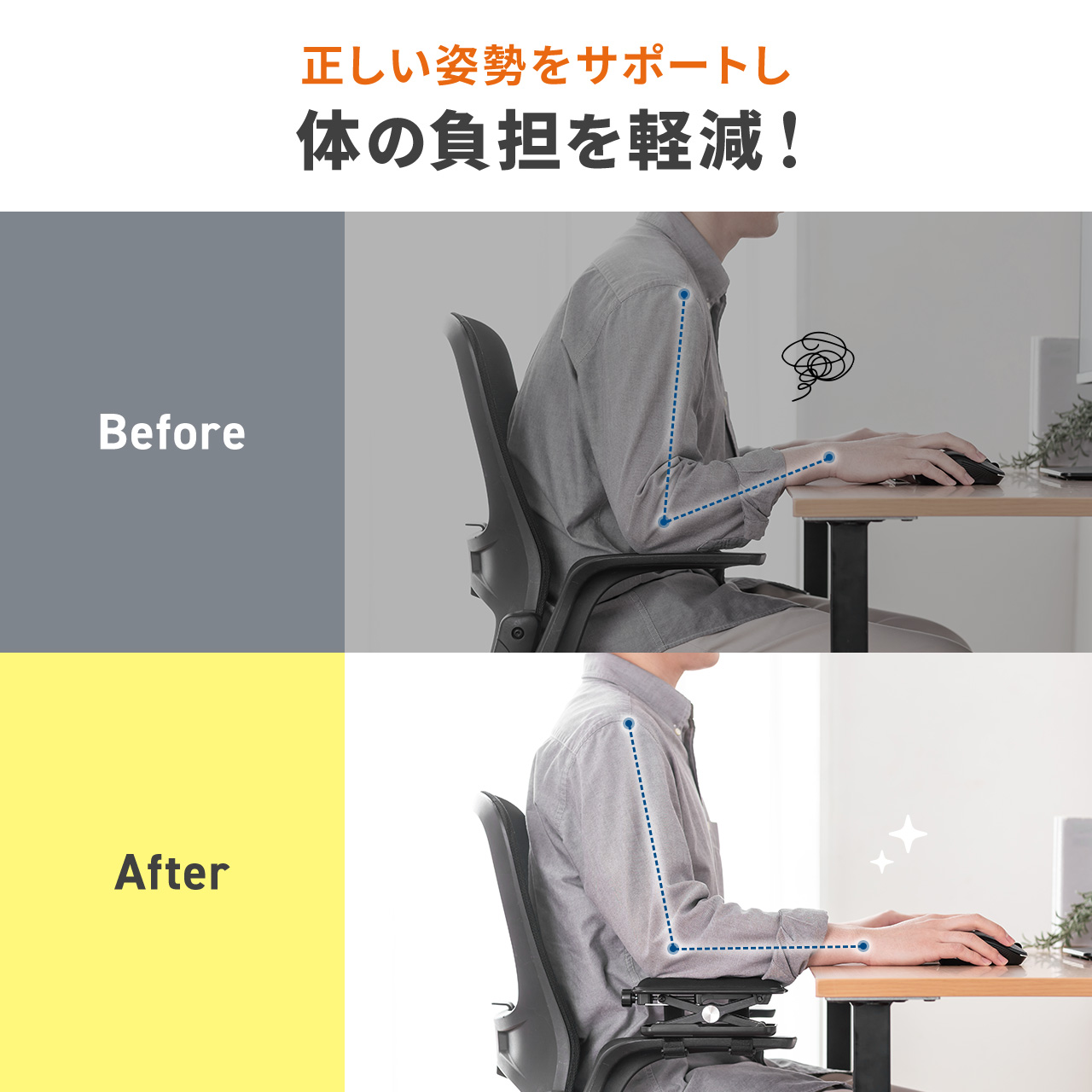 SANWA SUPPLY（サンワサプライ） 肘置き アームレスト 高さ調節可能 低