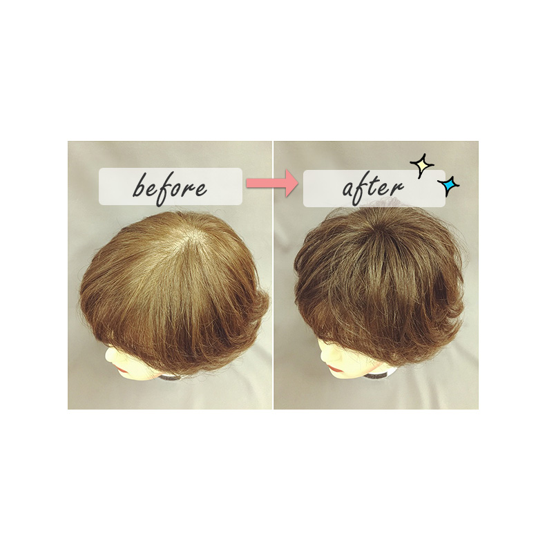 部分ウィッグ 頭頂部 人毛 100% 自然 トップピース 女性 ショート