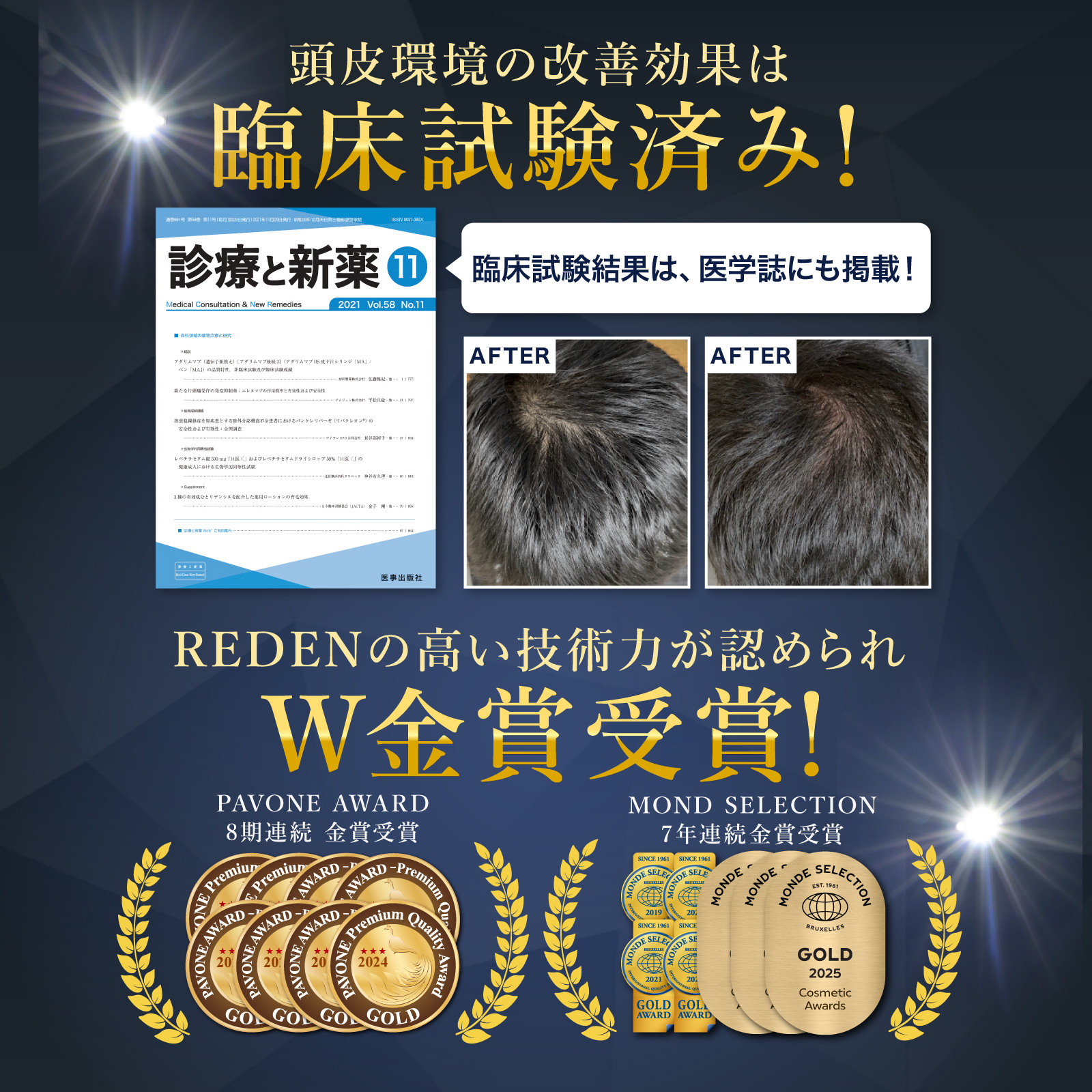 REDEN（リデン） 育毛剤 2本セット スカルプケア リデンシル 薬用育毛
