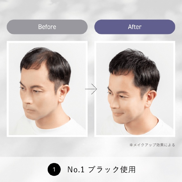 スーパーミリオンヘアーコンパクトセットNo.15ホワイト 10g+15mL