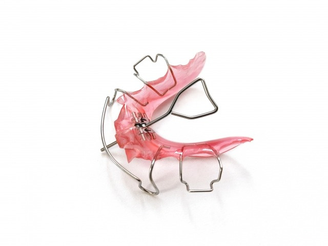 床矯正は大人でもできる？矯正治療を始める前に知っておきたいこと