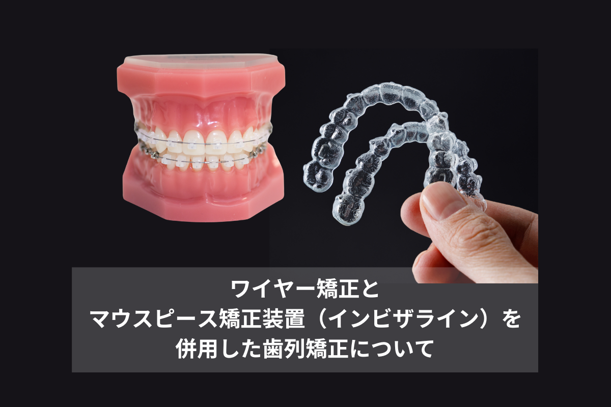 ワイヤー矯正とマウスピース矯正装置（インビザライン）を併用した歯列