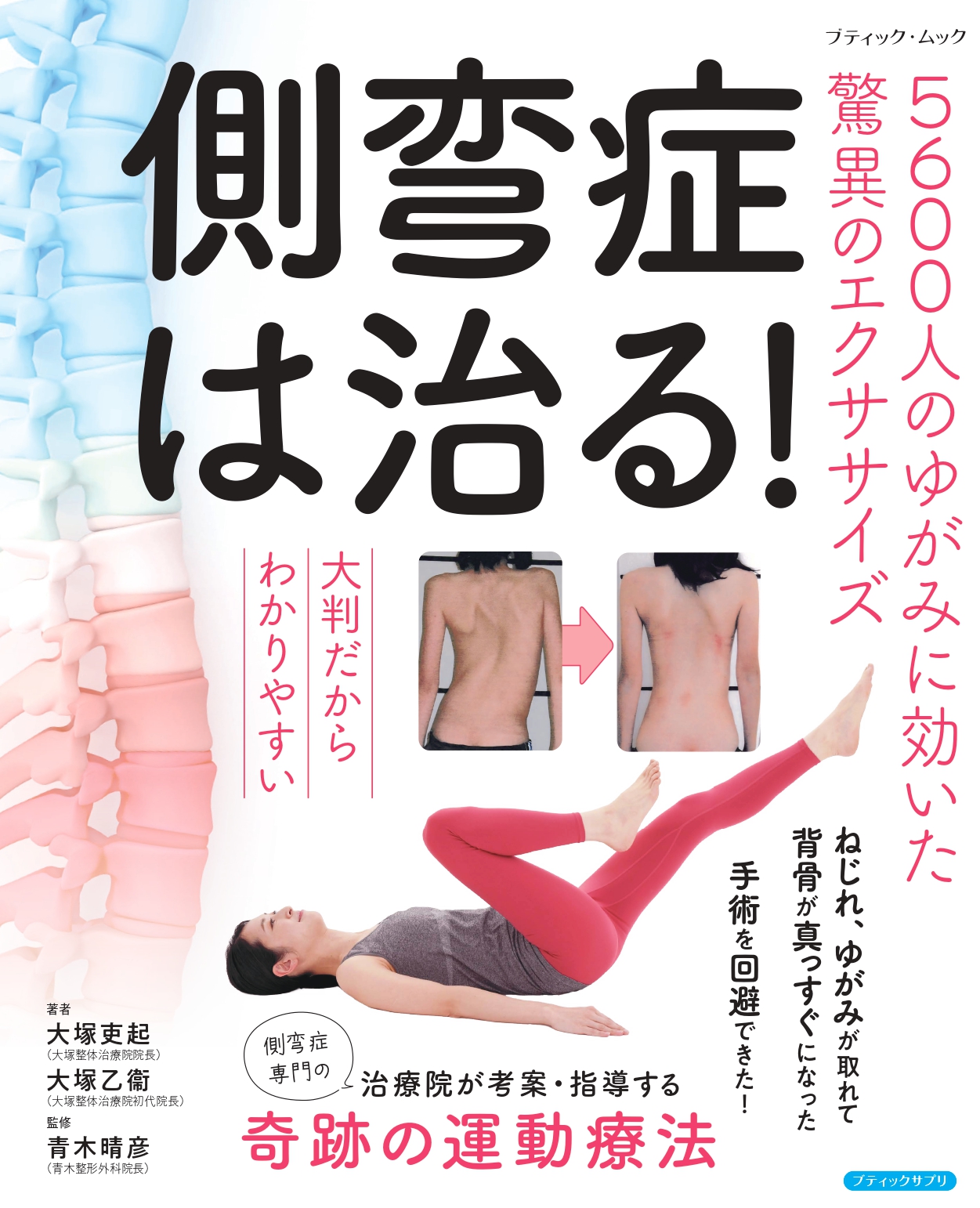 側弯症は治るの出版についてと装具の寿命について | 大塚整体治療院